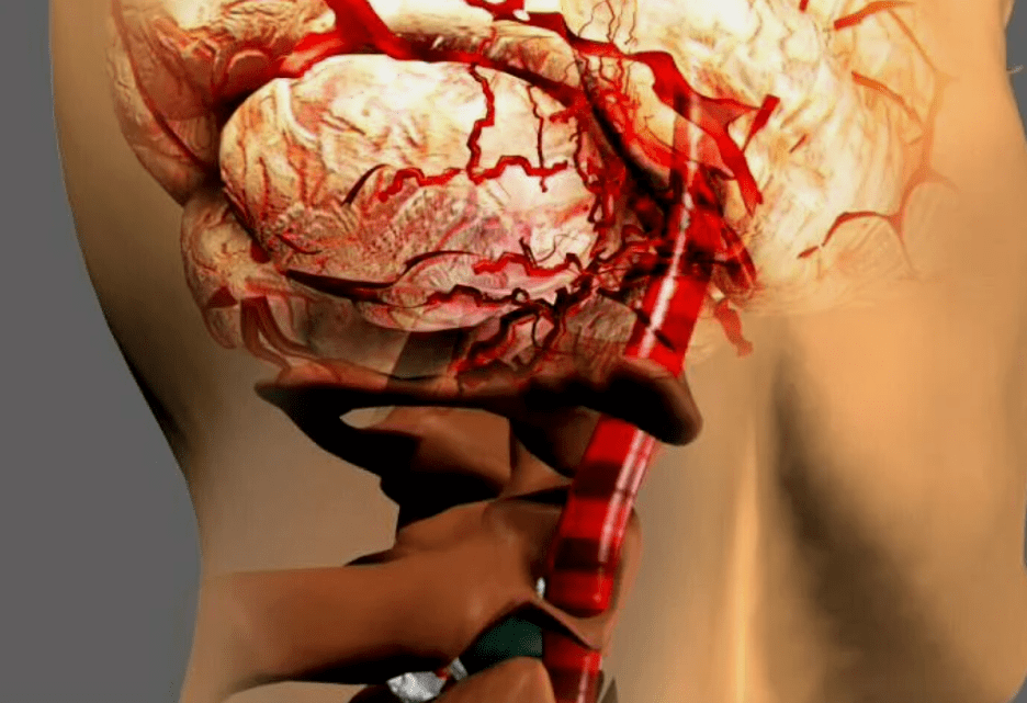 Cervical osteochondosis is dangerous