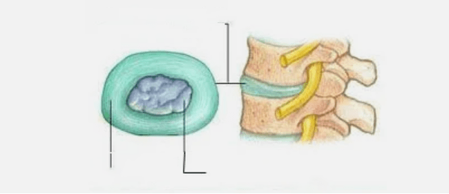 Nature of the osteochondrosis