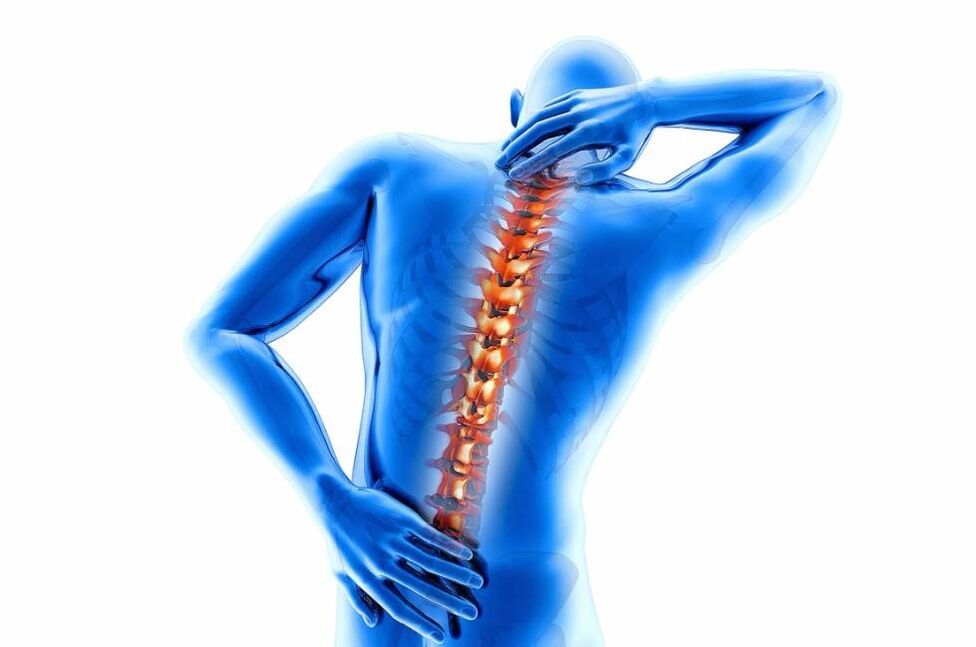 Osteochondrosis disease is accompanied by thinning of the intervertebral discs